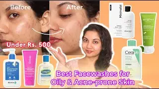 Best Facewash for Oily skin Under Rs. 500 || Best facewash for pimples & acne-prone skin