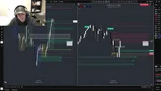 1.8R Long in 5 Minutes&hellip; Textbook Setup | Nov 05 Trade Recap