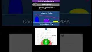 PISA  & Vena Contracta