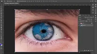 Cloudy Pupils