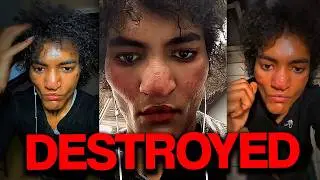 TikToker Destroys His Face Looksmaxxing | Jarion