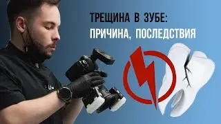Трещина в зубе: причина, последствия🤔novodenta.ru