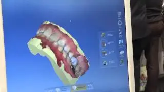 Sirona at IDS 2013: CEREC Software 4.2 - Virtual articulation