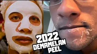 Пилинг Dermamelan 2022 — химический пилинг для лечения выраженной гиперпигментации