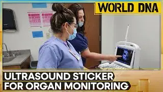 MIT engineers develop sticker for health monitoring | World Tech DNA | WION