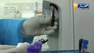 تخثر الدم أخطر ما تسببه كورونا..  هكذا يتم التعامل مع المرضى لتجنب الخطورة