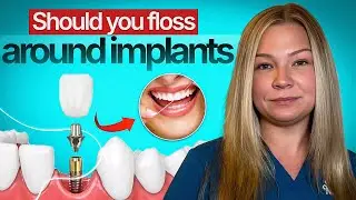 🦷 Should You Floss Around Implants? | Hygienist Heather