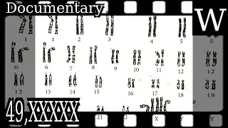 49,XXXXX - WikiVidi Documentary