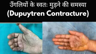 Dupuytren disease : problem hard nodules, thick skin and inability to straighten fingers completely