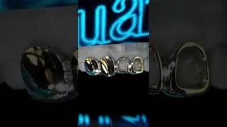 How to IntraOral Scan Grillz - LeVont Jewellery Limited