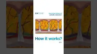 Emtone by BTL - How It Works