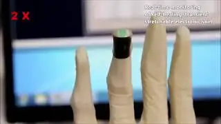 Stretchable, self-healing, transient macromolecular elastomeric gel for wearable electronics
