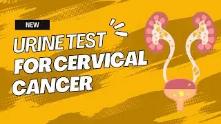 New Urine Test Shows Promise in the Early Detection and Prevention of Cervical Cancer