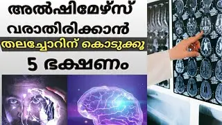 Brain disease / memory loos/ brain / 5 Best Brain stimulating food Malayalam