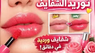 توريد الشفايف كورس كامل 2026
