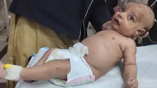 Bronchitis in Babies 👶🫁 | Symptoms, Treatment & Complete Baby Care #newborncare #baby #feeding