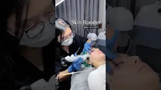 CANTIK TANPA RASA SAKIT  #skinbooster #amabelle #bandung #fypシ
