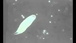 Wimpertierchen im Kl&auml;rschlamm unter dem Mikroskop betrachtet