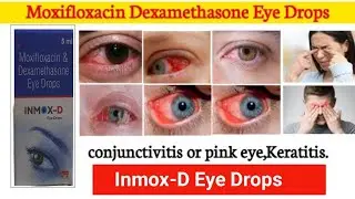 moxifloxacin & dexamethasone eye drops use in hindi | Inmox D Eye drops use side effects in hindi