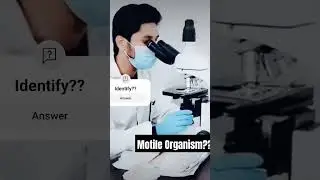 Motile Organism in Urine??Can uh identify?? #foryou #microscope #urineanalysis #video #science#MLT