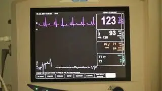Surgical Monitor