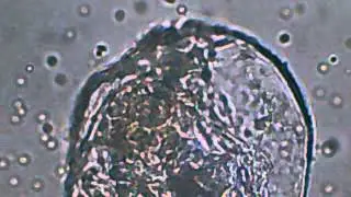 Brachionus rotundiformis or similar