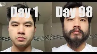 I Grew Out My Beard For 3 Months Using Minoxidil (Rogaine)