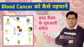 Blood Cancer के शुरुआती संकेत (Symptoms and Sign of AML ALL CML Explained)