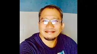 Pards Edo Xiaomi Note 10