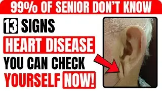 13 Visible Signs of HEART DISEASE You Can Check Yourself | Healthy Senior