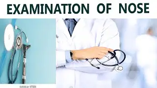 EXAMINATION OF NOSE  PART 4  LYMPH NODE  PALPATION (ENT  EXAMINATIONS)