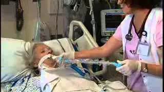 Tracheostomy Suctioning  Free Nursing Video Lecture