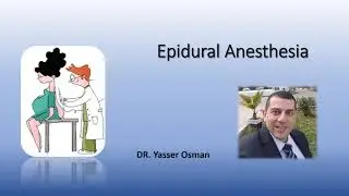 epidural anesthesia for undergraduate anesthesia students