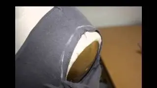 Shortening at shoulder