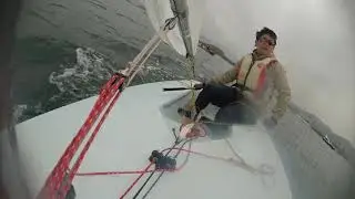 2018-04-07 TMT LASER XD