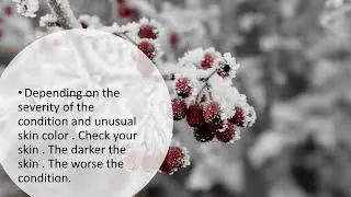 How to prevent frostbite