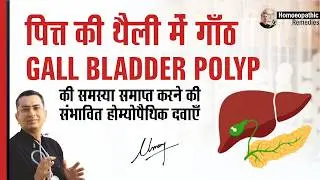 पित्त की थैली में गाँठ || Gall Bladder Polyps || Natural homeopathic remedies with symptoms