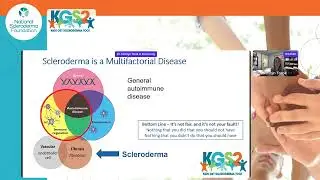 Overview of Systemic Scleroderma - in Kids, Teens, and Young Adults, Kathryn Torok, MD