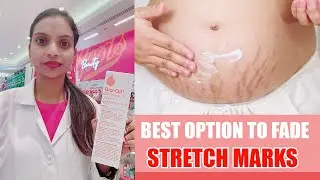 GOODBYE FOREVER - Stretch Marks | BIO OIL Review | Brown | Dark skin | pigmentation | stretch mark