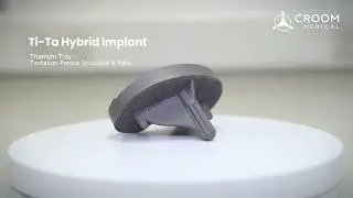 3D-Printed Ta Porous Structure | Titanium-Tantalum Tibial Tray