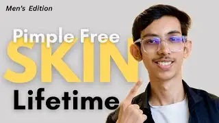Pimple Free Skin Lifetime | Mistakes & Habits That Ruining Your Skin | ManStyle Pratik