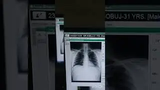 xray machine cr system fujifilm prima t2