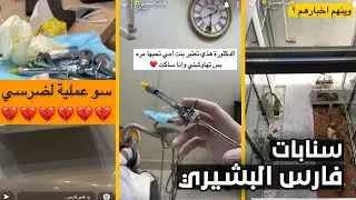 سنابات فارس البشيري | عملية لضرسي 😩