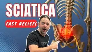How to Relieve Sciatica at Home&ndash;No Equipment! (Doctor Approved) FREE INSTRUCTIONAL PDF ⬇️