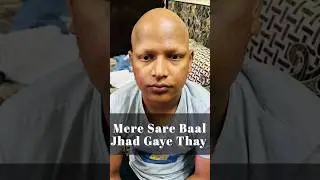 Alopecia Universalis Treatment in Ghaziabad: Effective Solutions for Hair Loss