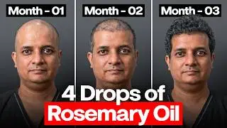 Is Rosemary Oil BEST to REVERSE Hair loss Naturally? | How To Apply It? (100% Honest Advice)