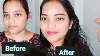ಚಿಂತಿಸಬೇಡಿ ಒಂದೇ use ಗೆ ವ್ಯತ್ಯಾಸ ನೋಡಿ ಈ tips fallow ಮಾಡಿ skin bright ಆಗುತ್ತೆ ✨️😍#trending #kannada 