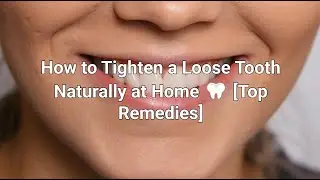 How to Tighten a Loose Tooth at Home  [Top Home Remedies]