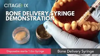 How To Use A Bone Delivery Syringe Demonstration - Bone Grafting | Citagenix