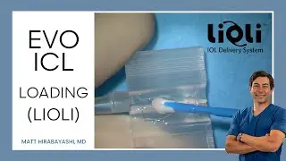 ICL Loading with Lioli (Tutorial + Tips and Tricks)